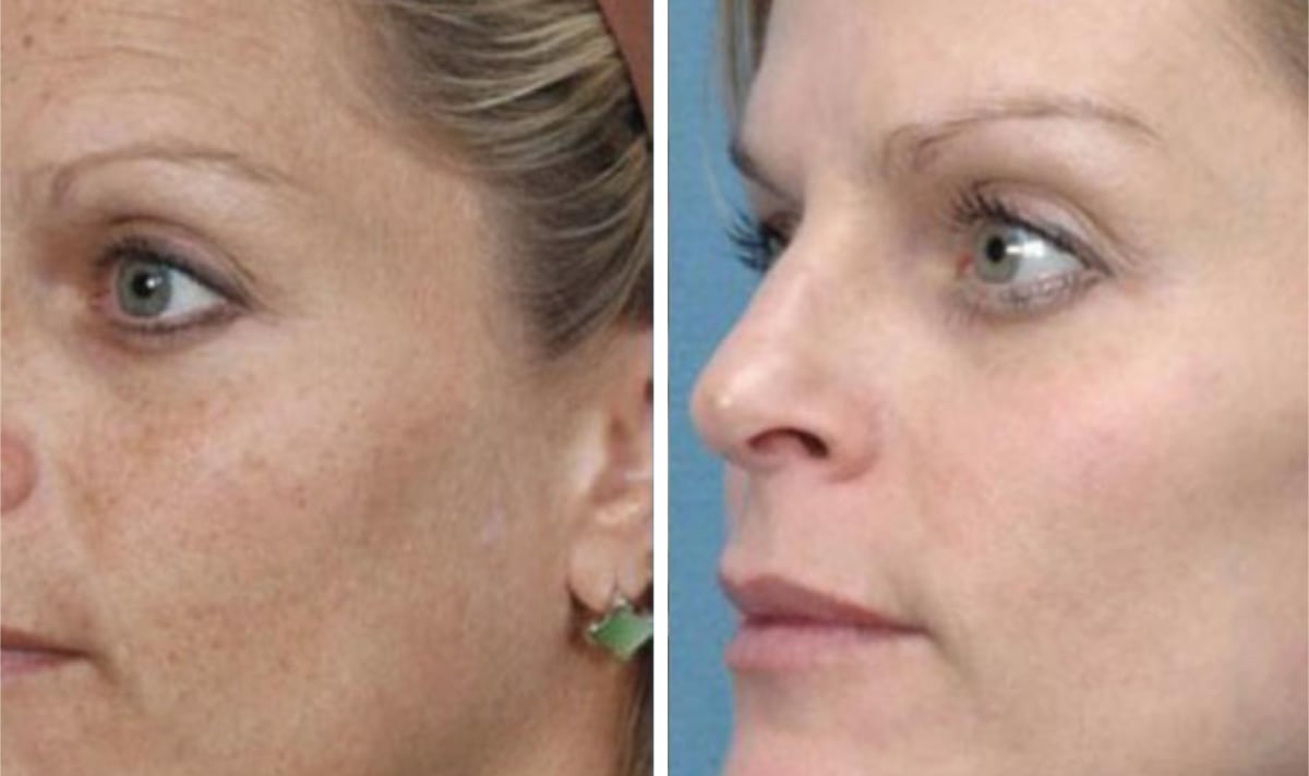 Soin Skin Ethik pour corriger l'hyperpigmentation